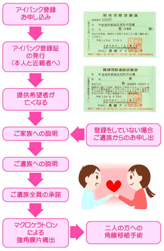 献眼までの流れ